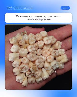 Коллекция трофеев хирурга — от мема до импланта.